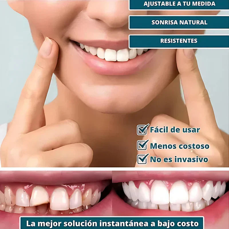 SmilePro 🦷 - Carillas Dentales Ajustables De Resina + ESTUCHE REGALO - ¡Últimas unidades! PACK 2X1