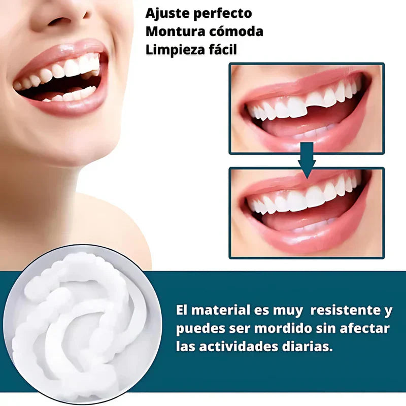 SmilePro 🦷 - Carillas Dentales Ajustables De Resina + ESTUCHE REGALO - ¡Últimas unidades! PACK 2X1