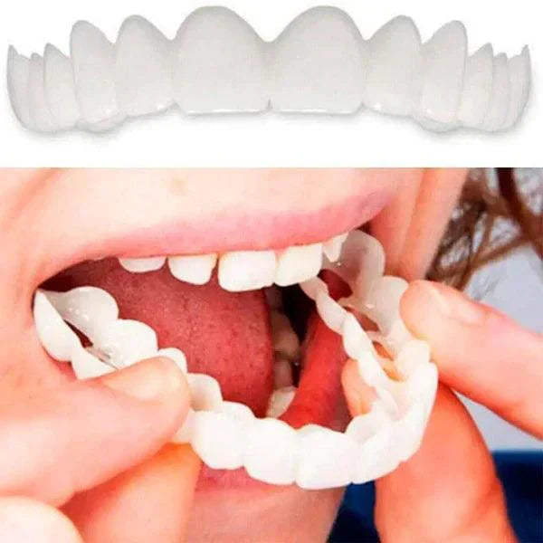 SmilePro 🦷 - Carillas Dentales Ajustables De Resina + ESTUCHE REGALO - ¡Últimas unidades! PACK 2X1